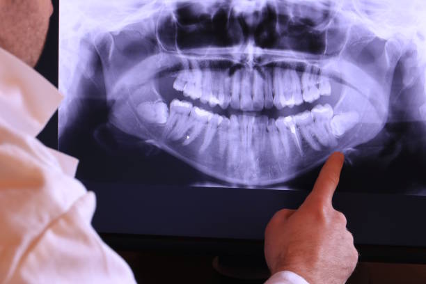 Best Broken Tooth Emergency  in Oakland, MD