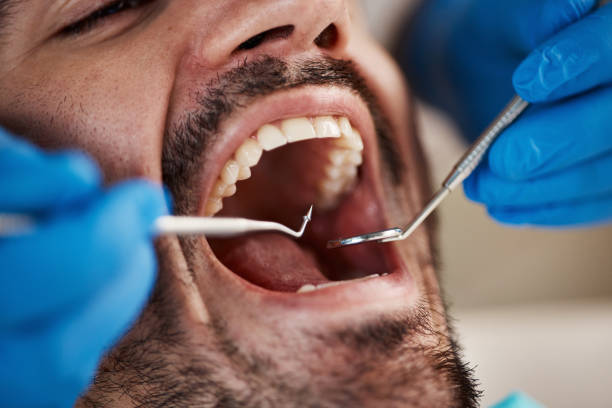 Best Teeth Whitening  in Oakland, MD