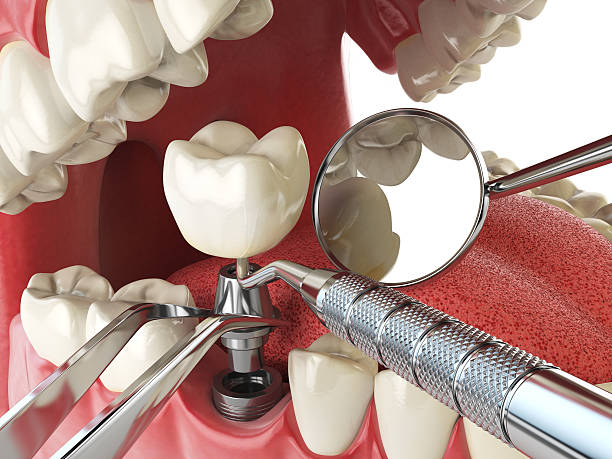 Best Tooth Pain Emergency Relief  in Oakland, MD